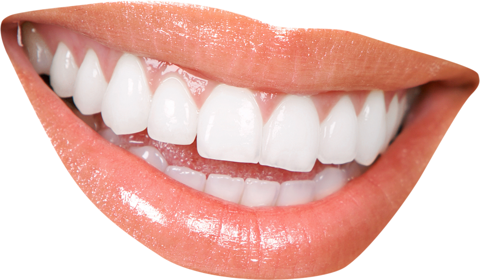 Close Up Of A Woman's Mouth With White Teeth