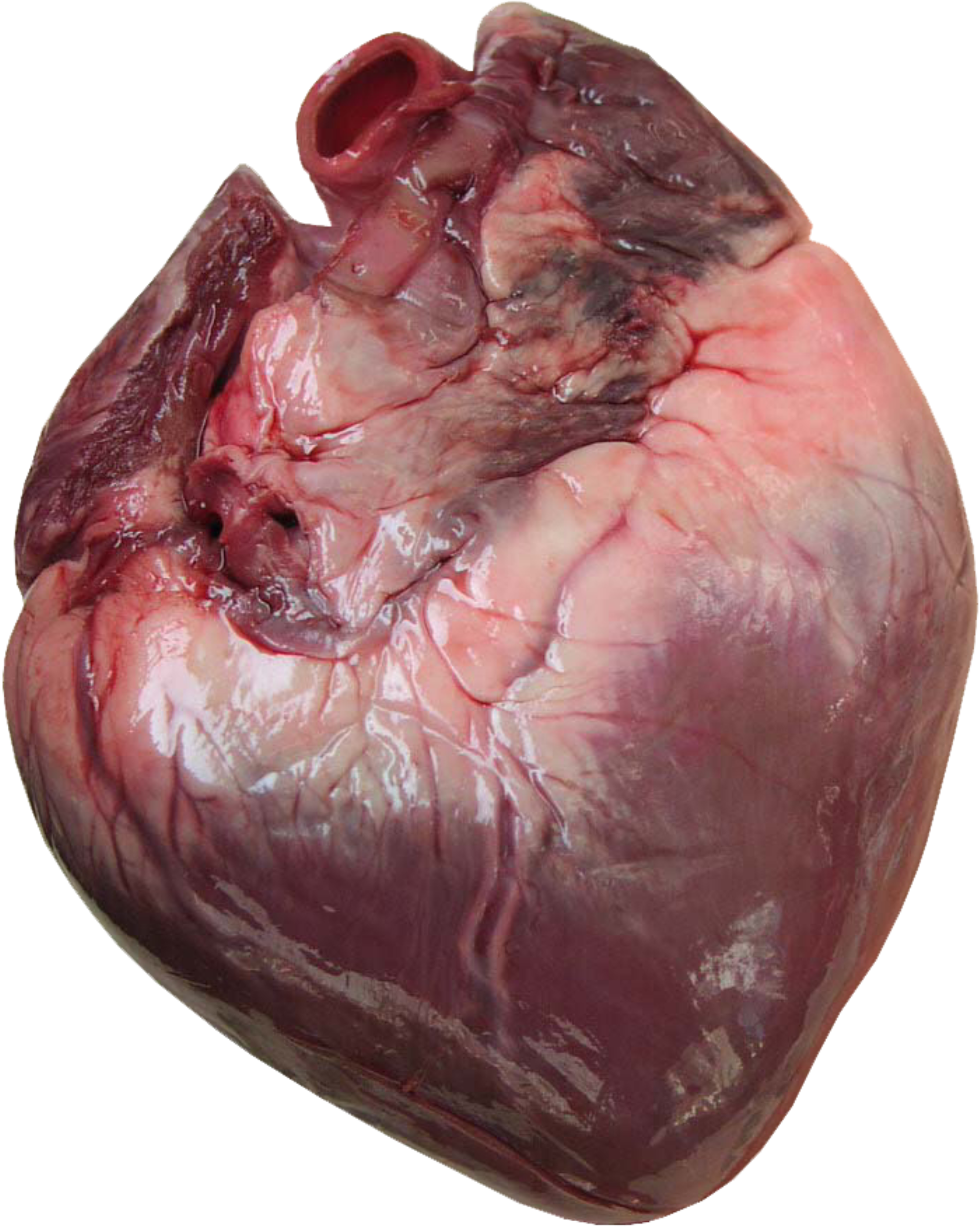 A Close Up Of A Heart