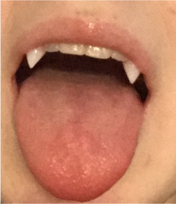 A Close Up Of A Person's Mouth With Teeth And Fangs