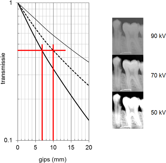 A Graph Of Teeth And A Graph Of Teeth
