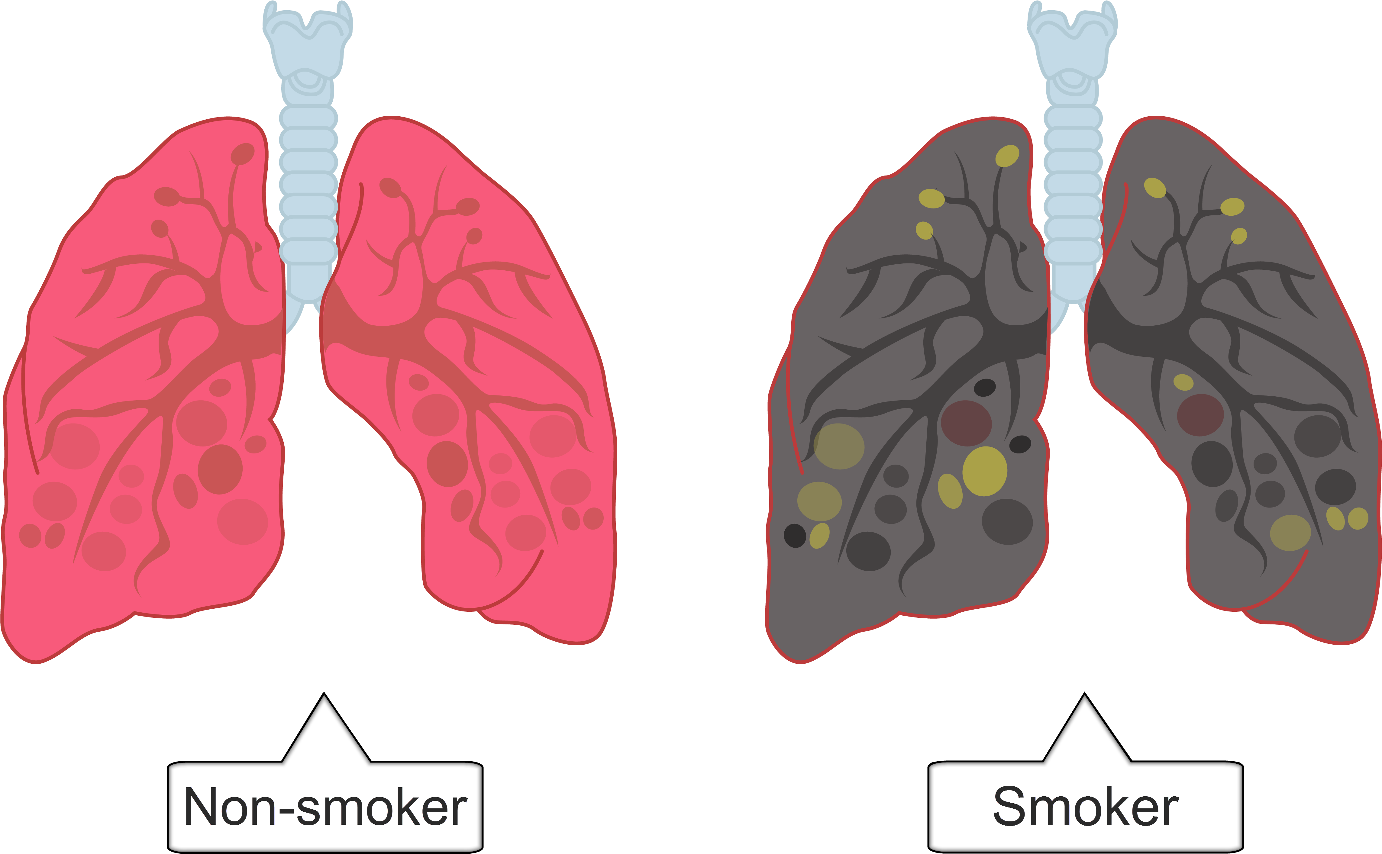 A Diagram Of Lungs With Text