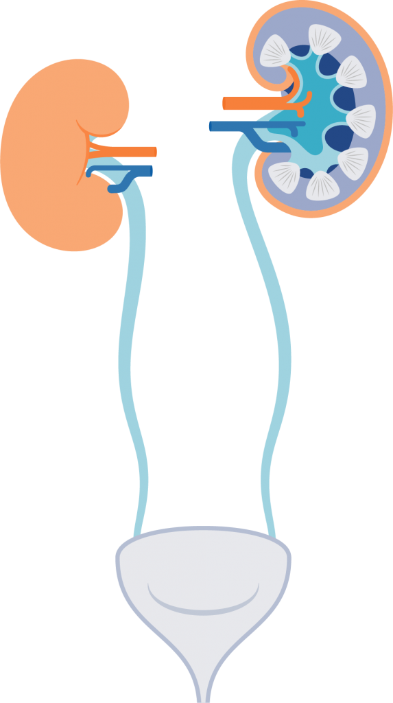 A Diagram Of A Kidney System