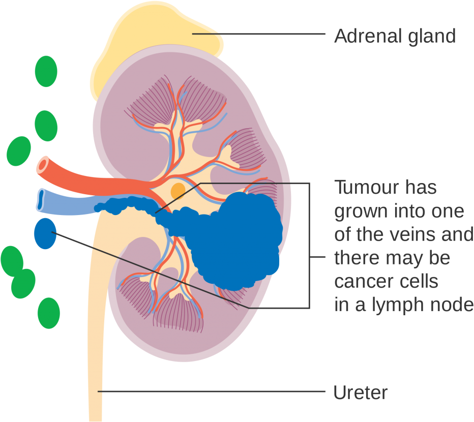 A Diagram Of A Kidney