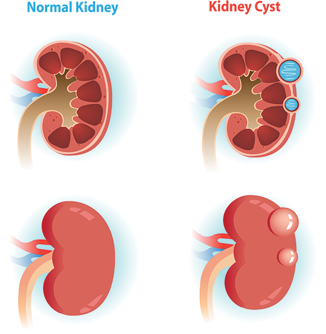 A Diagram Of Different Types Of Kidneys