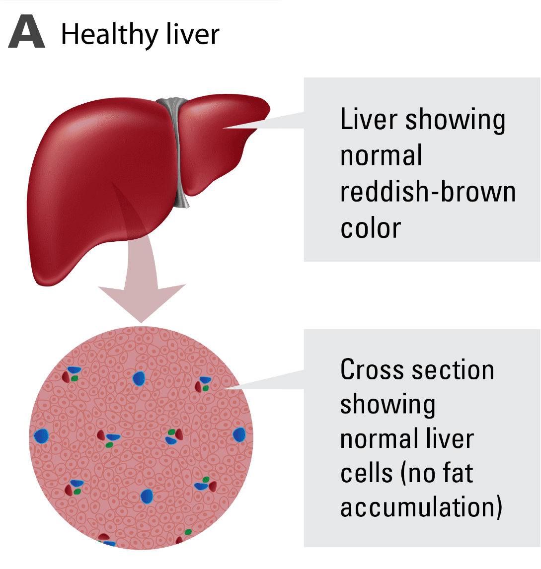 A Diagram Of A Healthy Liver