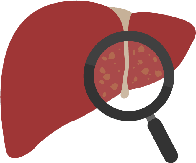 A Magnifying Glass Over A Liver
