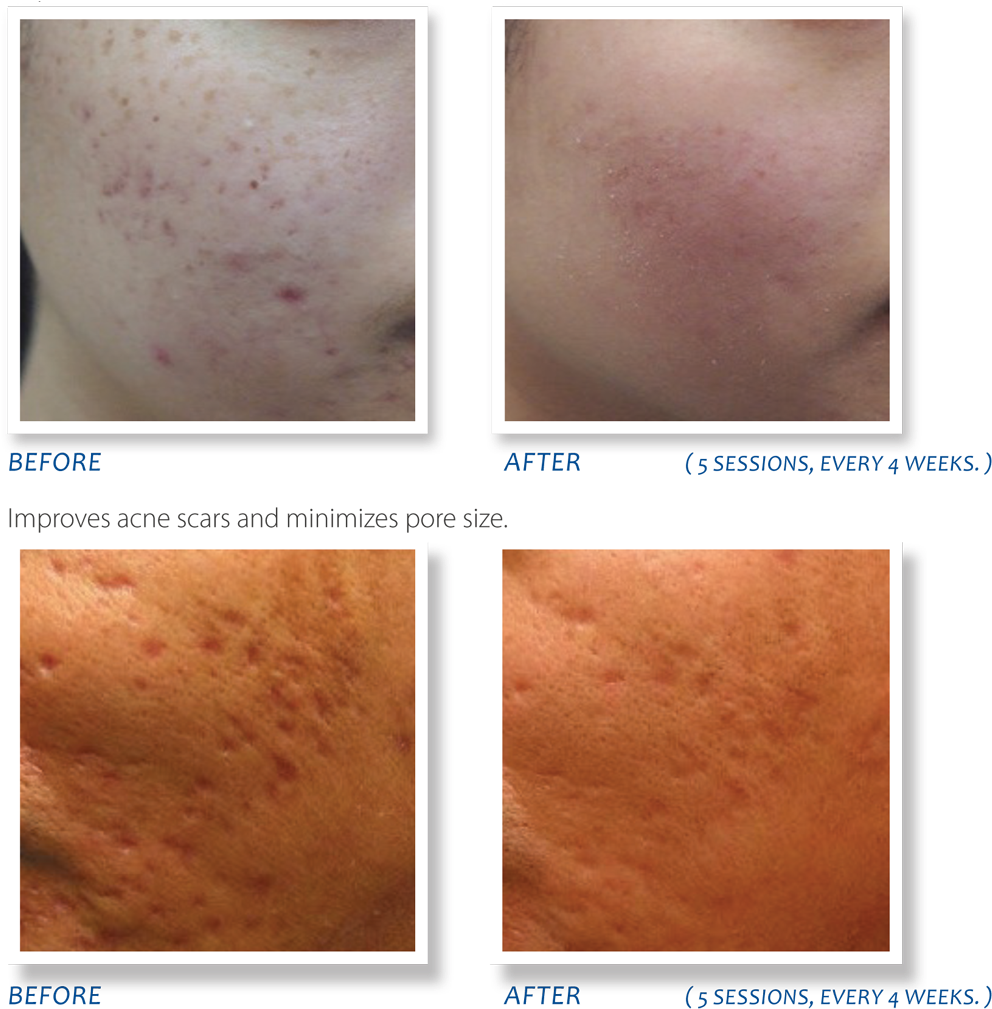 A Collage Of Skin Problems