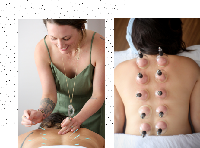 A Woman Using Cupping Therapy On A Man's Back