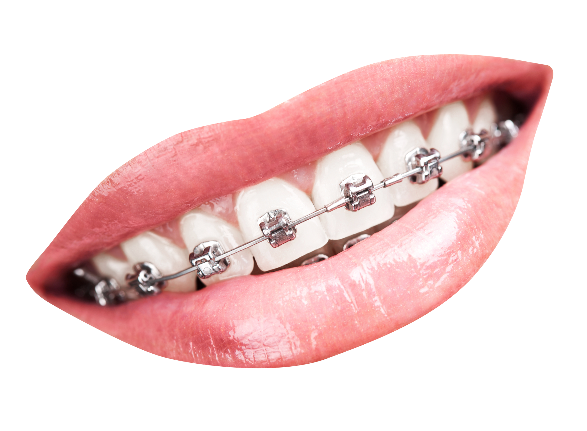 Teeth Png 1940 X 1427