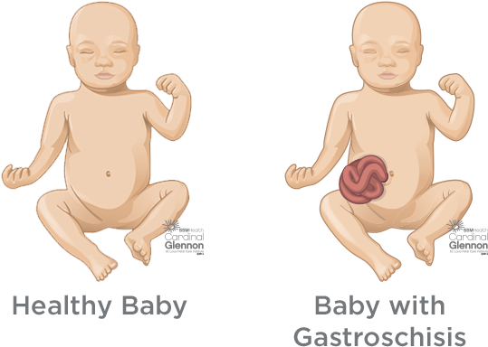Womb Png 539 X 384